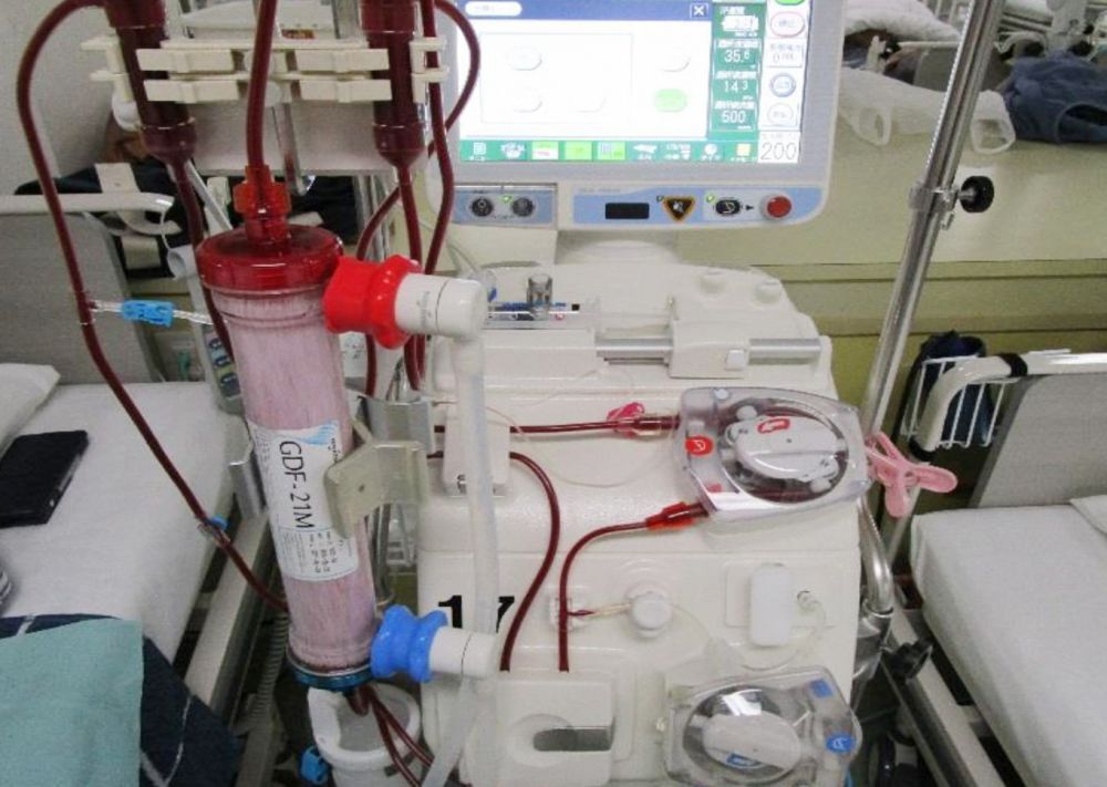 透析用監視装置