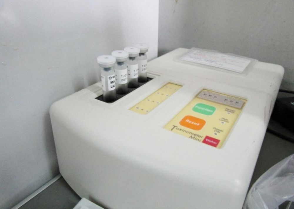 エンドトキシン測定と細菌検査